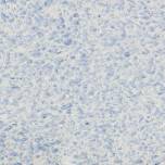 Silk Plaster Рельеф 326 жидкие обои